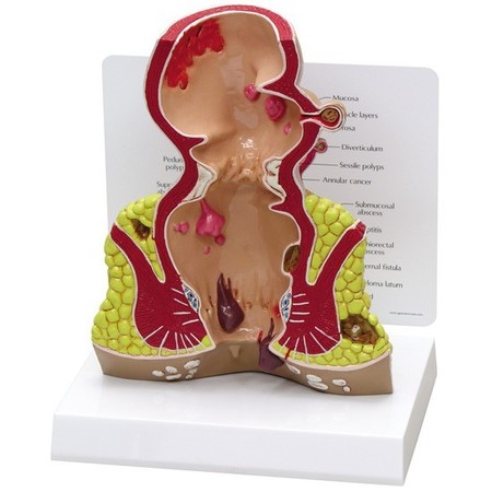 GPI ANATOMICAL Anatomical Model - Rectum 3350